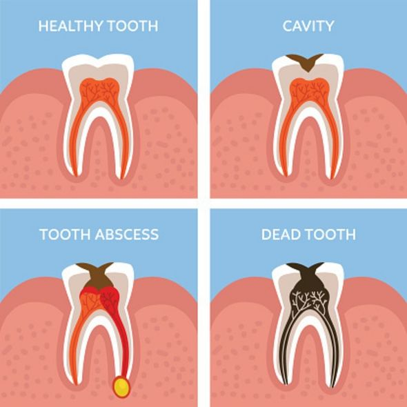 tooth treatment