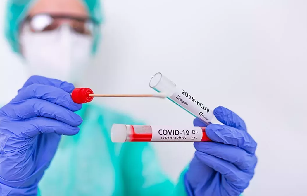 RT PCR test Covid 19