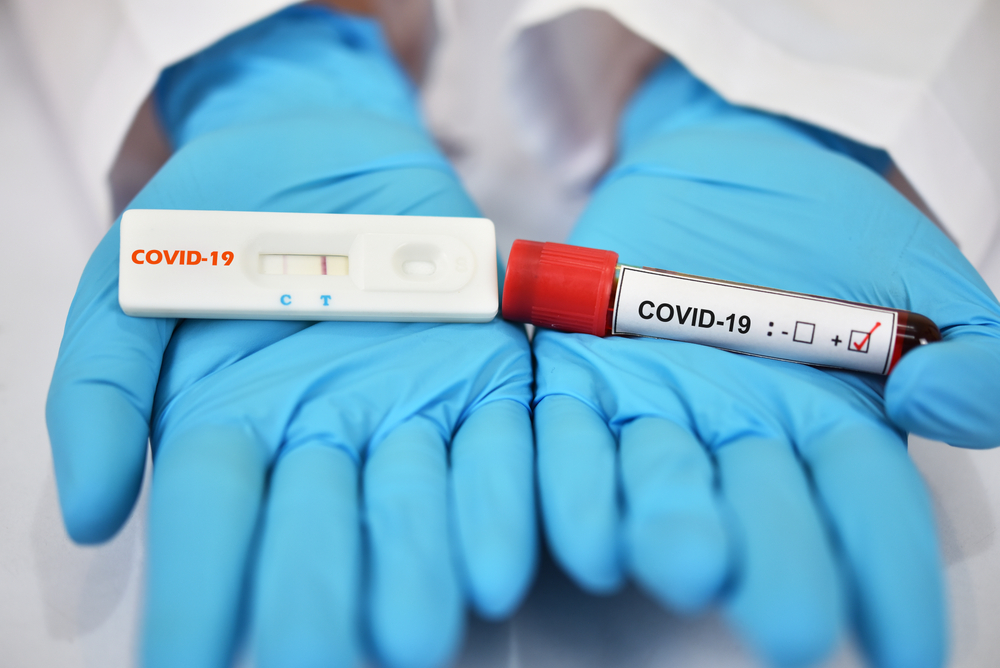 RT PCR test Covid 19